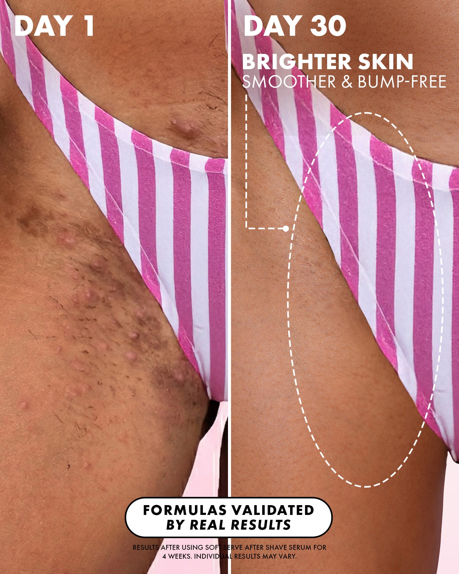 03_BeforeAfterSoftServeAfterShaveOil_Truly_Amazon_PDP_1500x1875_eb758834-39c4-4d78-9a03-3aedac65d0ce.jpg