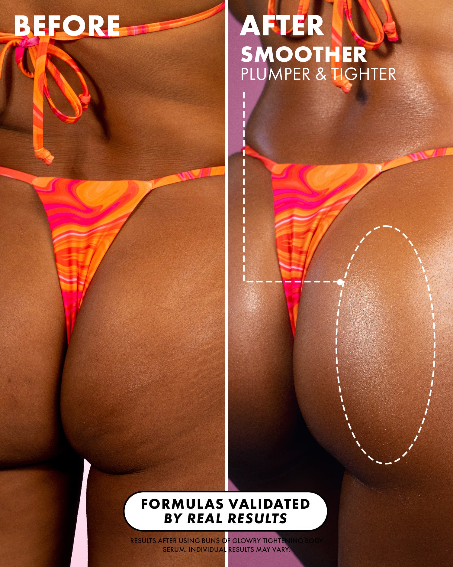 03_BeforeAfter_BunsofGlowrySerum_PDP_1500x1875_66cd0a9e-fb1b-418c-944b-62478bb87906.jpg