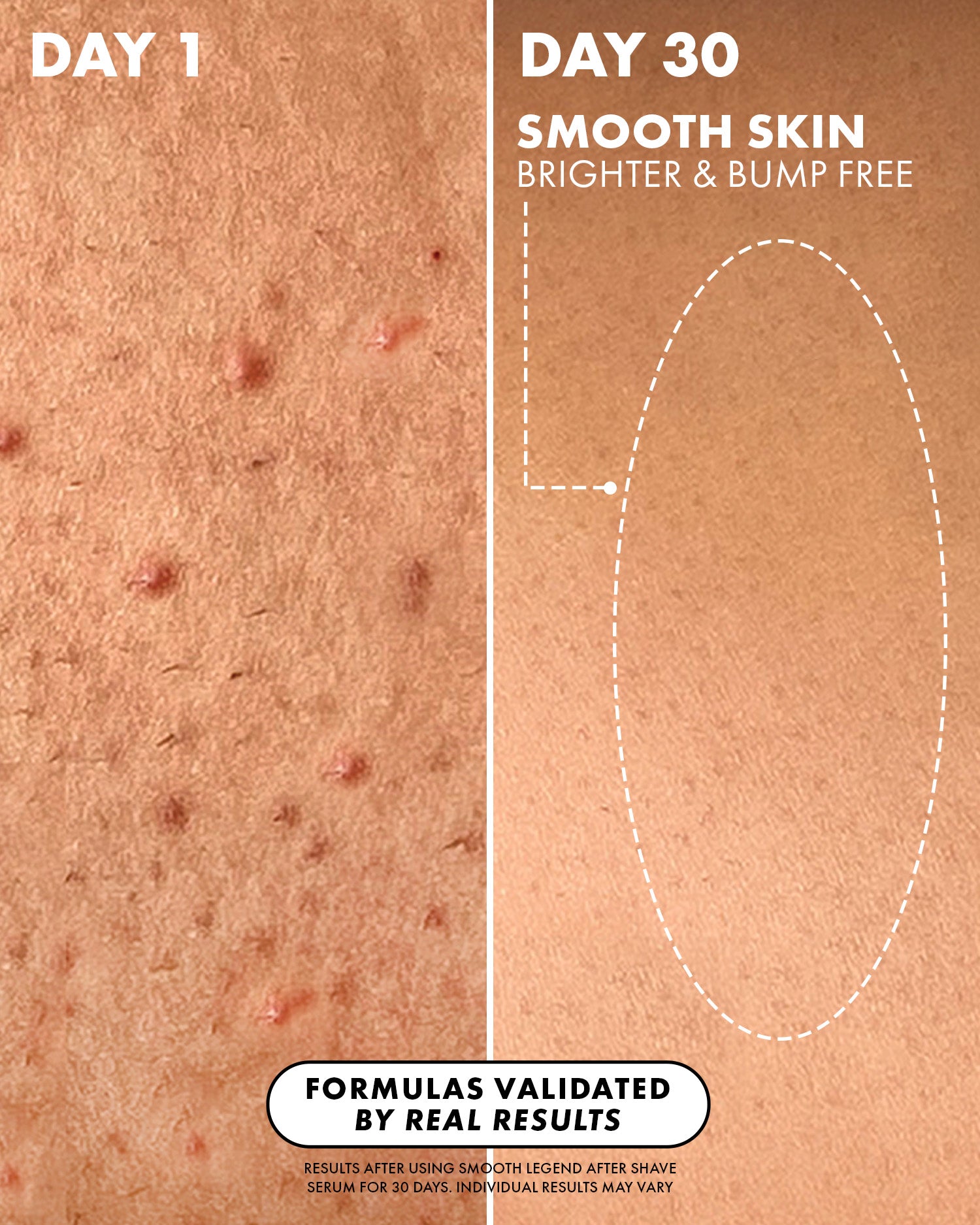 03_BeforeAfter_SmoothLegendAfterShaveSerum_Truly_Amazon_PDP_1500x1875_56f4e907-9570-405f-80eb-44e36d5ffe03.jpg