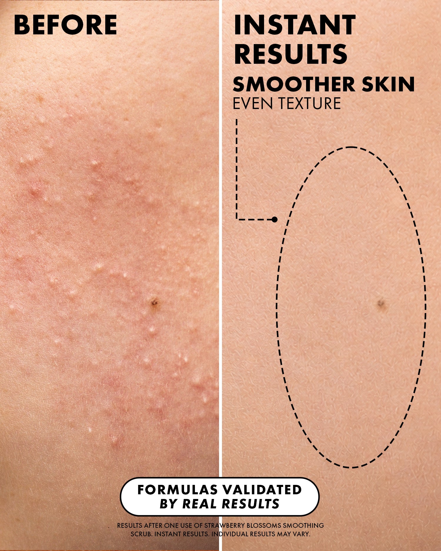 03_BeforeAfter_StrawberryBlossomsTrio_Truly_Amazon_PDP_1500x1875_8884ce63-e9db-4393-943a-74f47d23f21a.jpg