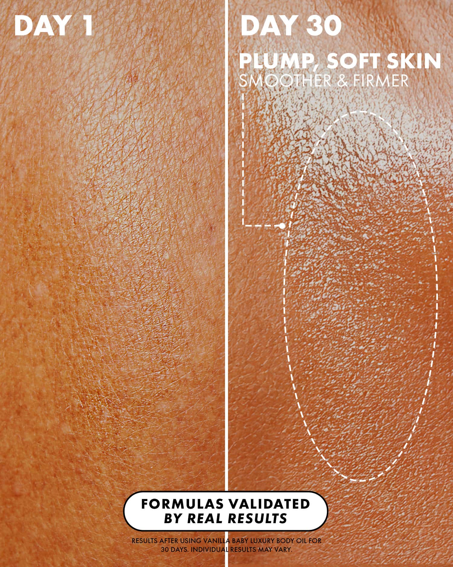 03_BeforeAfter__Vanilla_Baby_Body_Oil_PDP_1500x1875_de9b4e44-8bf2-40c7-bd9a-ab1b2e790d72.jpg