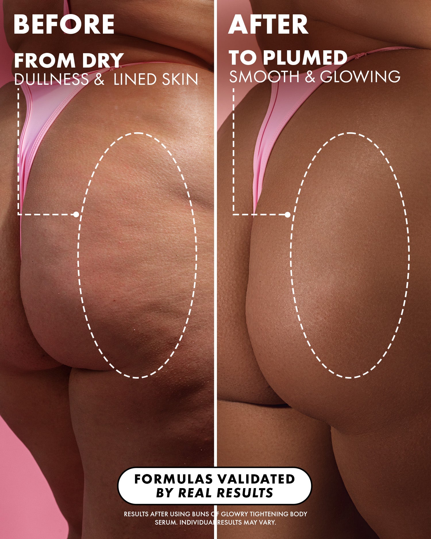 07_BeforeAfterZoomedout_BunsofGlowrySerumPDP_1500x1875_78c46d0a-512a-495f-b2a4-e16852a28f23.jpg