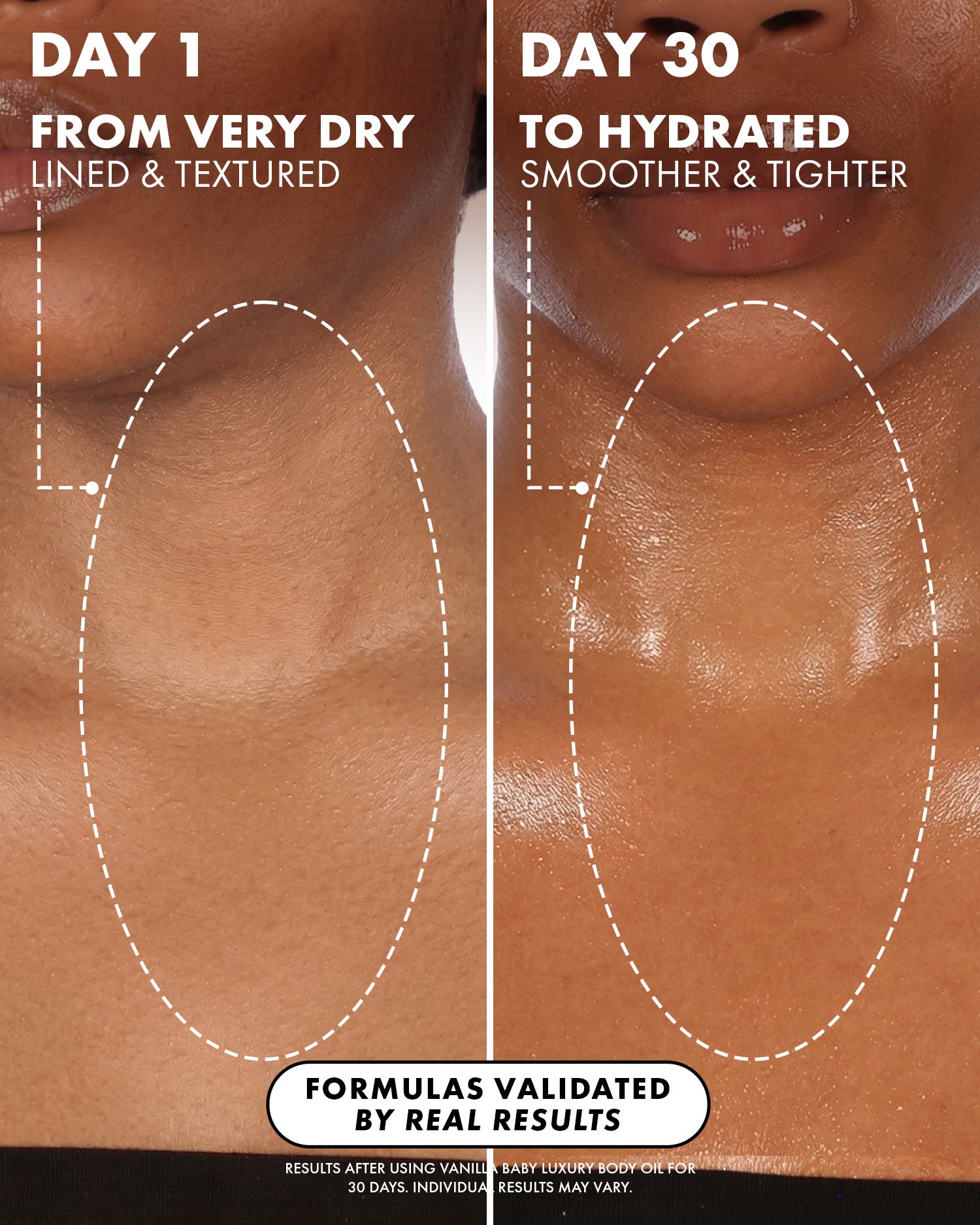 07_BeforeAfterZoomedout__Vanilla_Baby_Body_Oil_PDP_1500x1875_9f126f81-305d-4a3c-aa58-88934f98e8ba.jpg