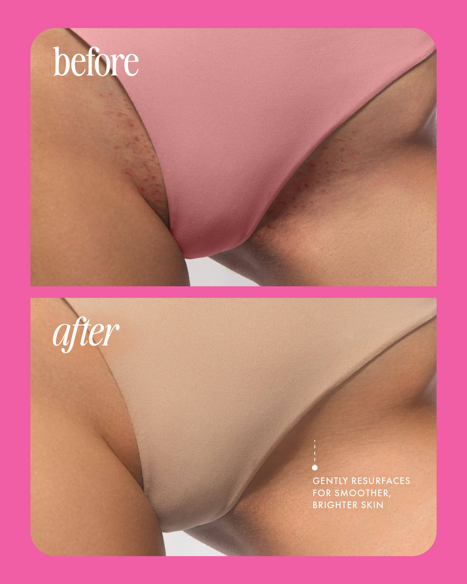 BEFOREAFTER_dad8786d-dcce-4b86-a941-a3aa67bbfb0b.jpg